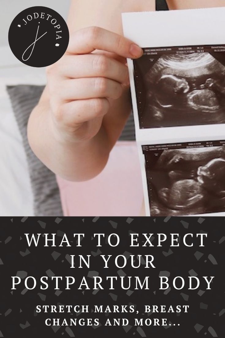 what to expect in your postpartum body - pinterest graphic